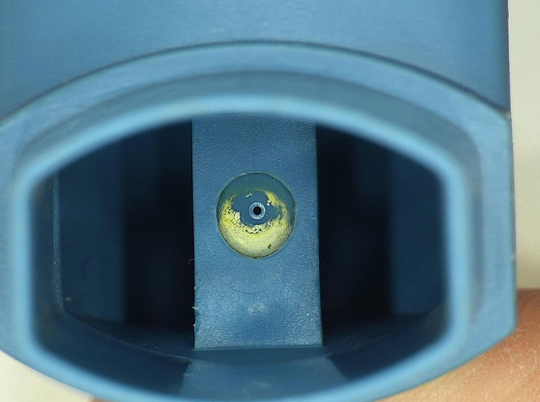 plastic component under magnification